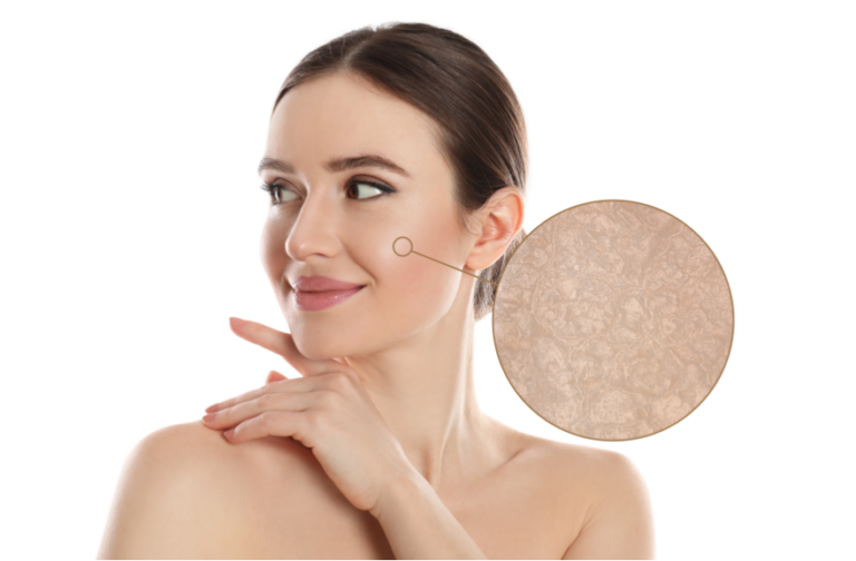 Have Crepey Skin? Here’s How You Can Address It